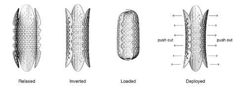 The shell  lace stent developed by Tonkin Liu and Arup